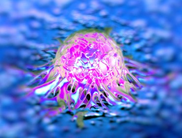 Image d'une cellule cancéreuse de la prostate
