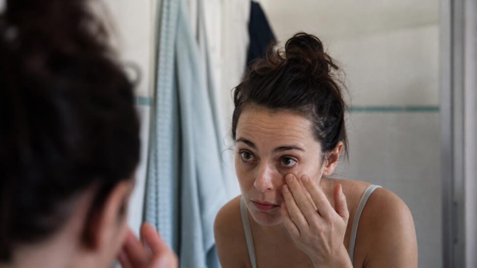 Les cernes sous les yeux ne viennent presque jamais dʼun manque de sommeil