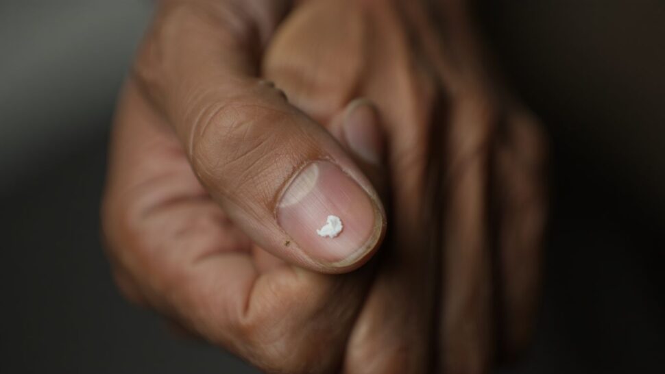 Une petite tache blanche sur lʼongle du pouce nʼa rien à voir avec le calcium