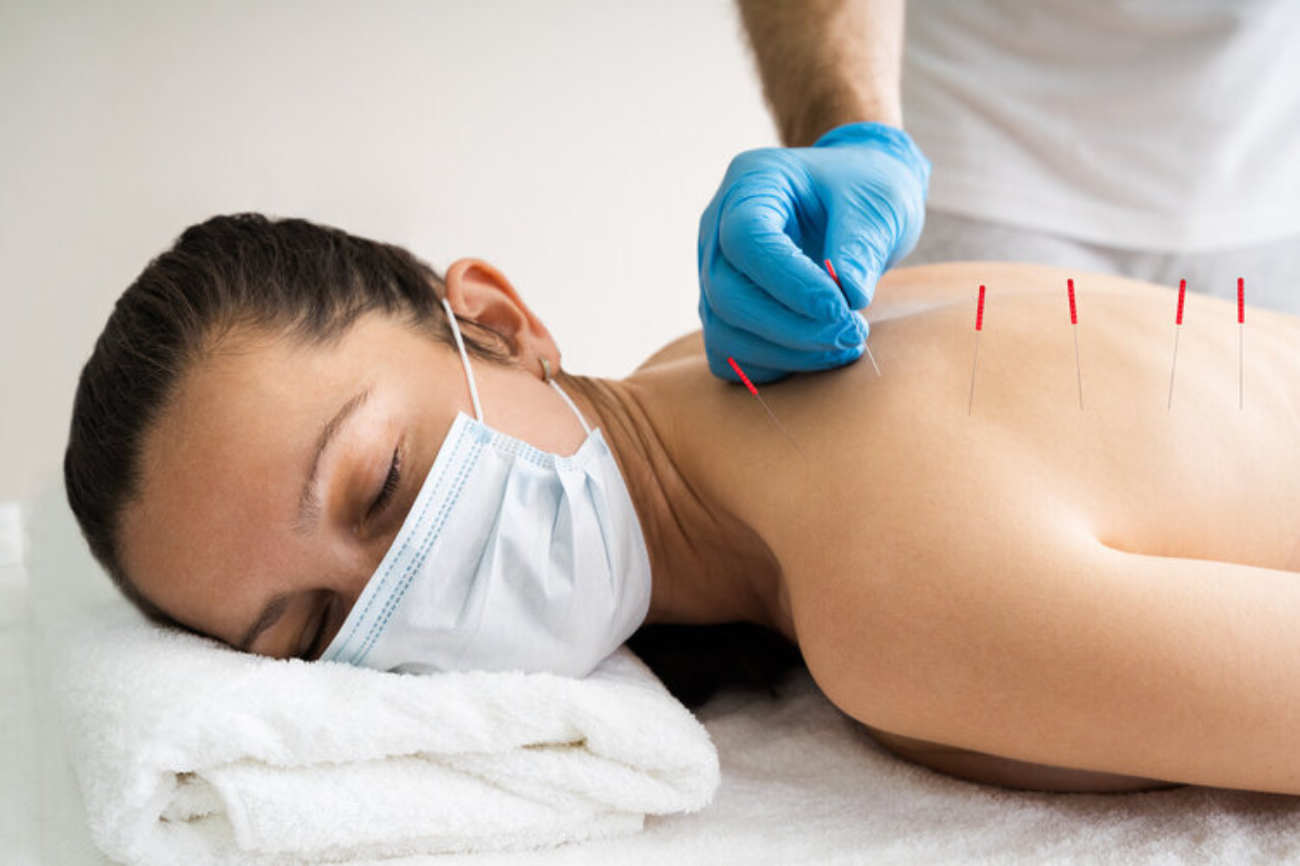 Jeune femme en séance d'acupuncture