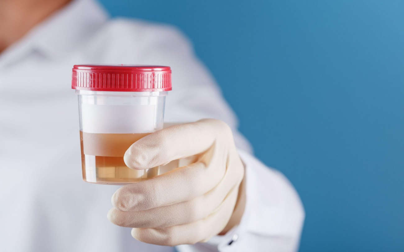 Sang dans les urines (hématurie) : quelles sont les causes ?| Le ...