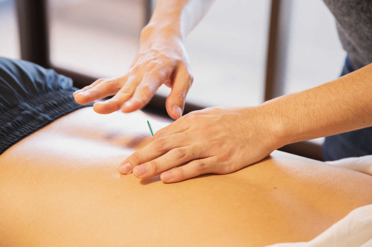 L'acupuncture en médecine chinoise