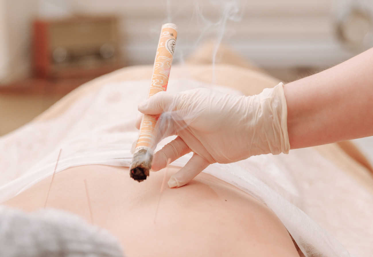 La moxibustion asiatique