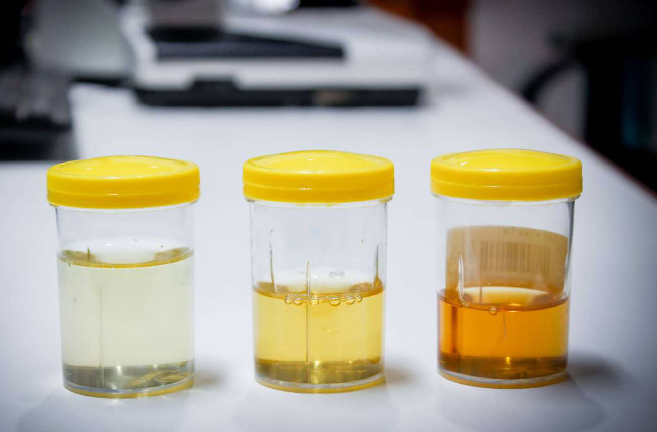 Flacon d'urines avant un test