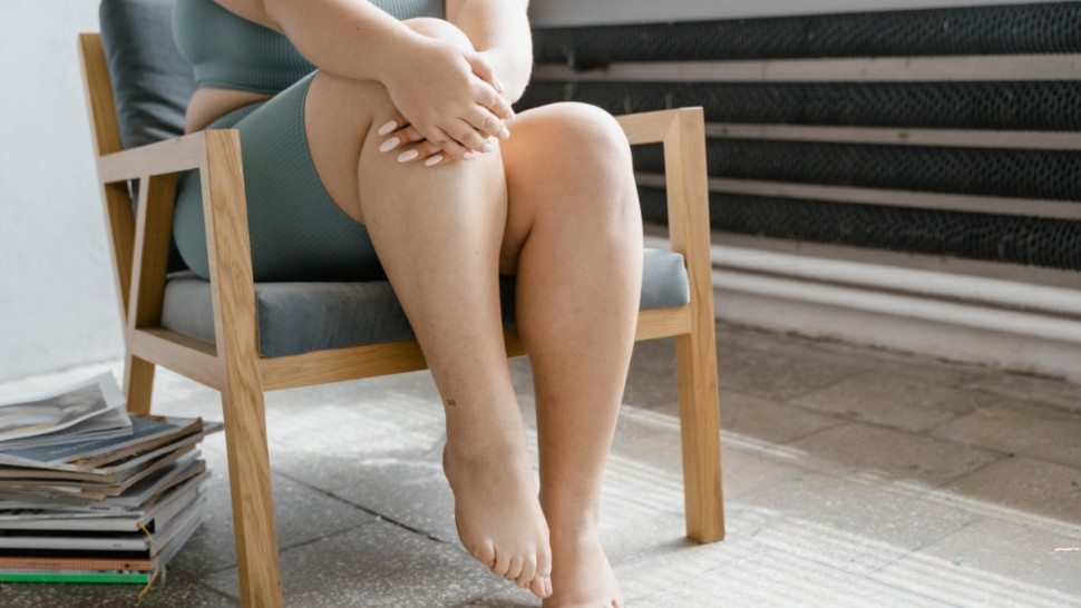 An obese woman sitting on a chair