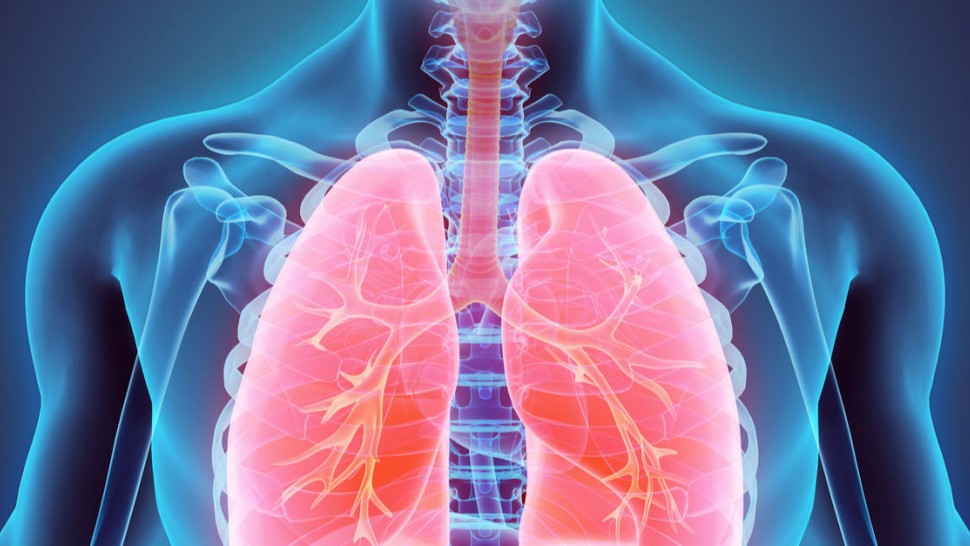 Radiographie des poumons : ambolie pulmonaire
