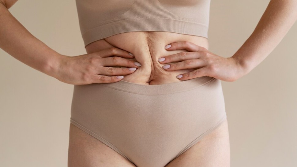 Efficacité à long terme de la sleeve gastrectomie dans le traitement de l'obésité morbide