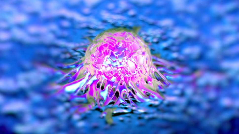 Image d'une cellule cancéreuse de la prostate