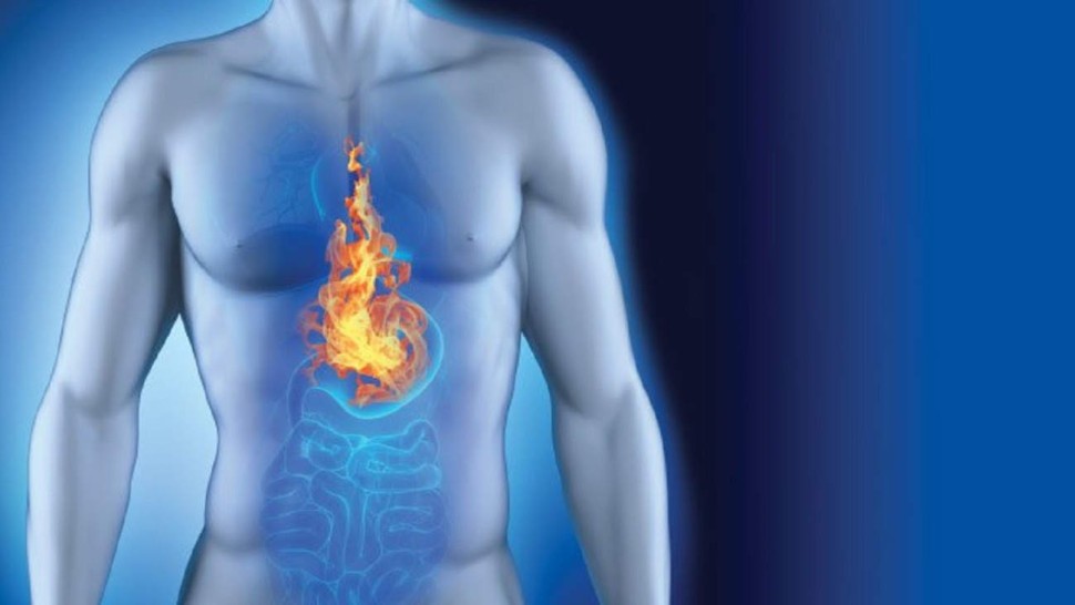 Exemple de reflux gastro-œsophagien (RGO)