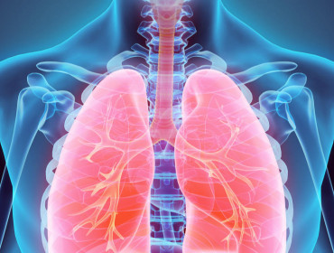 Radiographie des poumons : ambolie pulmonaire