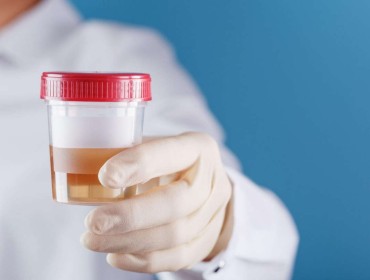 Analyse de sang dans les urines