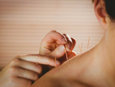 Une femme qui est se fait une séance d'acupuncture