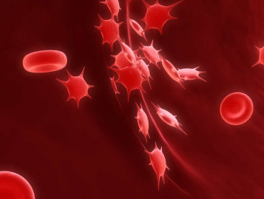 Analyse des plaquettes sanguines