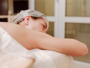 Femme en séance d'acupuncture