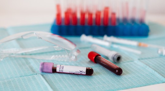 Analyse de sang humain en laboratoire 